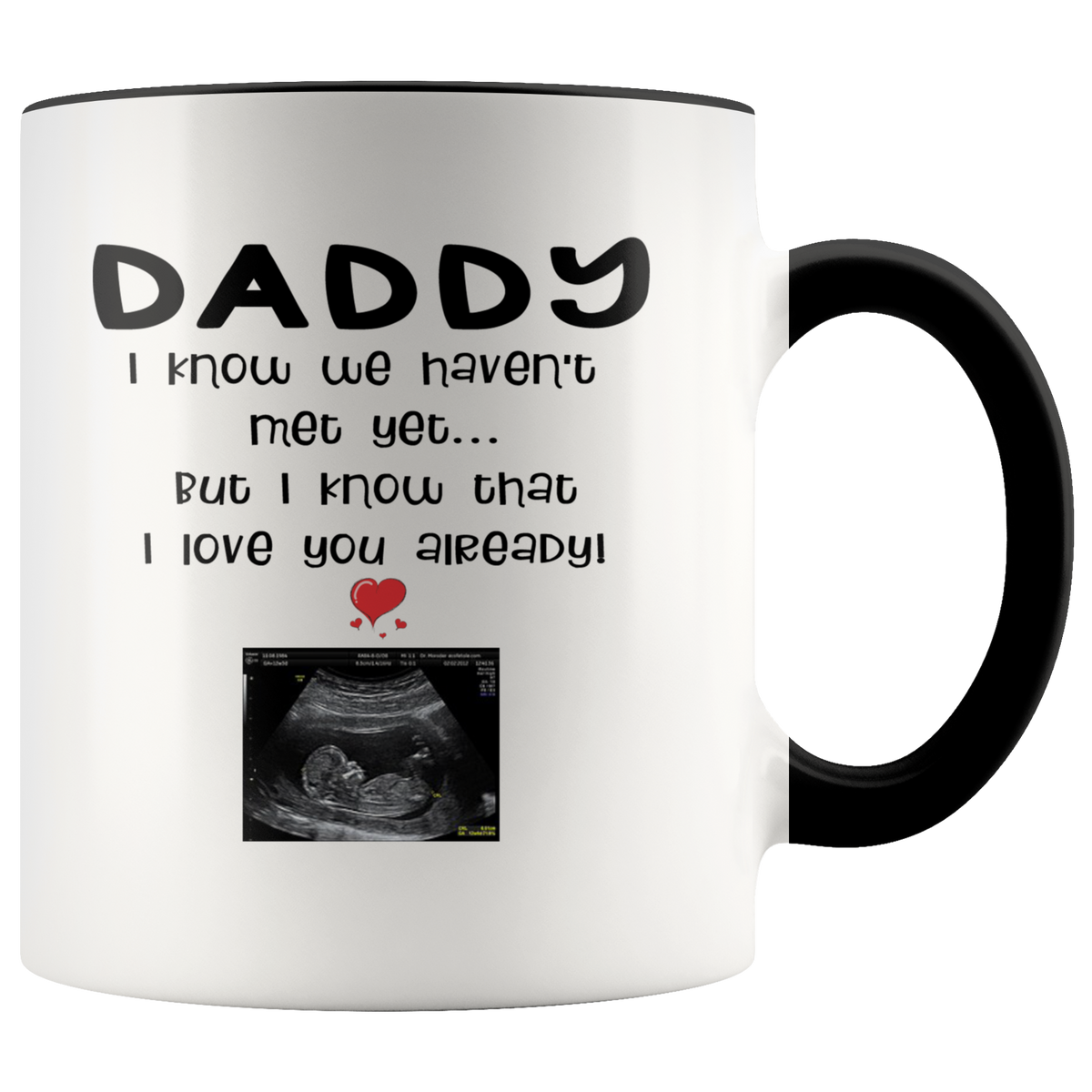 Personalized Dad Mug With Your Baby's Ultrasound Image For New Expectant Dad (black)
